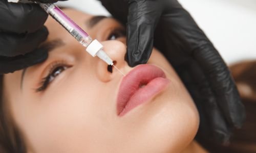 What is Juvederm?