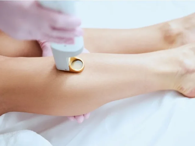 What are the Benefits of Laser Skin Resurfacing?