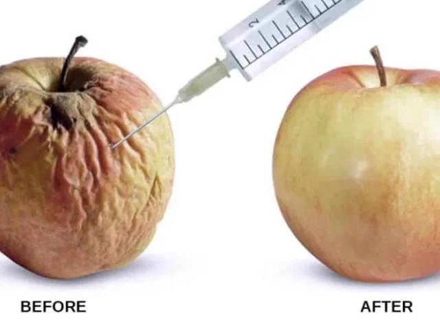 HOW LONG DOES SCROTOX LAST?